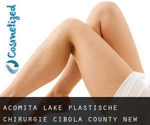 Acomita Lake plastische chirurgie (Cibola County, New Mexico)