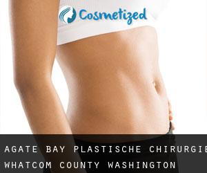 Agate Bay plastische chirurgie (Whatcom County, Washington)