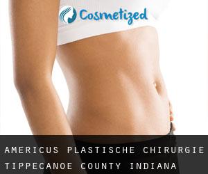 Americus plastische chirurgie (Tippecanoe County, Indiana)