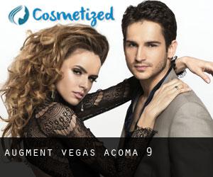 Augment Vegas (Acoma) #9