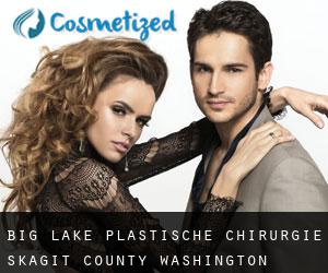 Big Lake plastische chirurgie (Skagit County, Washington)