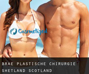 Brae plastische chirurgie (Shetland, Scotland)