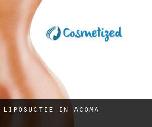 Liposuctie in Acoma