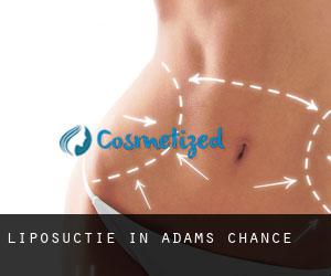 Liposuctie in Adams Chance