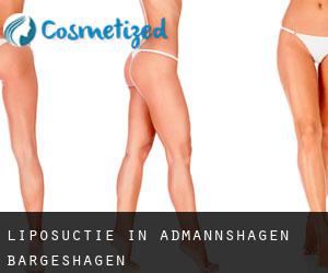 Liposuctie in Admannshagen-Bargeshagen