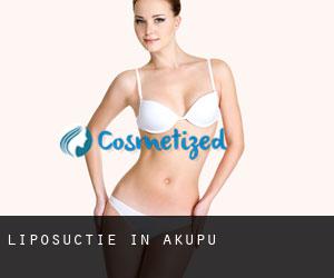 Liposuctie in Akupu