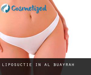 Liposuctie in Al Buḩayrah
