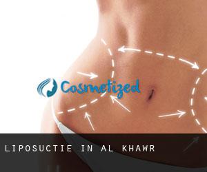 Liposuctie in Al Khawr