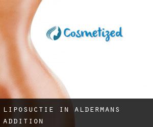 Liposuctie in Aldermans Addition