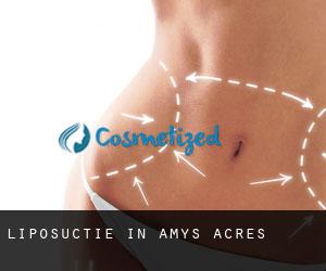 Liposuctie in Amys Acres