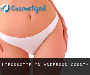 Liposuctie in Anderson County