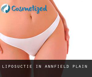 Liposuctie in Annfield Plain