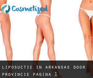 Liposuctie in Arkansas door Provincie - pagina 1
