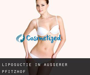 Liposuctie in Äusserer Pfitzhof