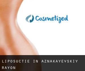 Liposuctie in Aznakayevskiy Rayon