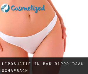 Liposuctie in Bad Rippoldsau-Schapbach