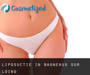 Liposuctie in Bagneaux-sur-Loing