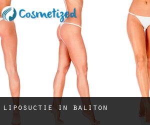 Liposuctie in Baliton