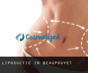 Liposuctie in Beaupouyet