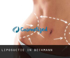 Liposuctie in Beckmann