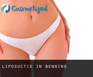 Liposuctie in Benning