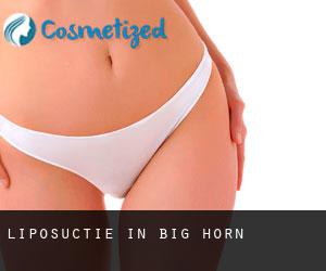 Liposuctie in Big Horn