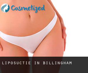 Liposuctie in Billingham