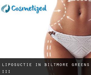 Liposuctie in Biltmore Greens III