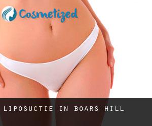Liposuctie in Boars Hill