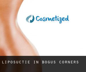 Liposuctie in Bogus Corners