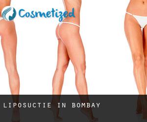Liposuctie in Bombay