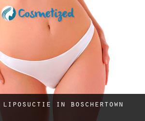 Liposuctie in Boschertown