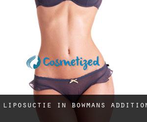 Liposuctie in Bowmans Addition