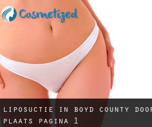 Liposuctie in Boyd County door plaats - pagina 1