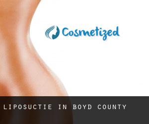 Liposuctie in Boyd County