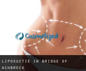 Liposuctie in Bridge of Achbreck