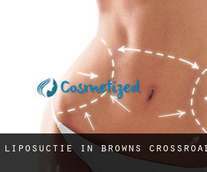 Liposuctie in Browns Crossroad