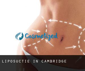 Liposuctie in Cambridge