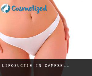 Liposuctie in Campbell