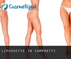 Liposuctie in Campretti