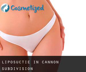 Liposuctie in Cannon Subdivision