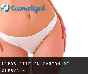 Liposuctie in Canton de Clervaux
