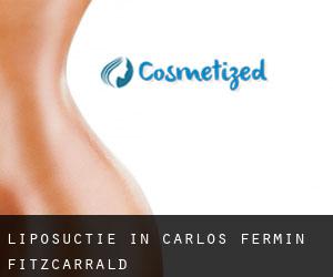 Liposuctie in Carlos Fermin Fitzcarrald