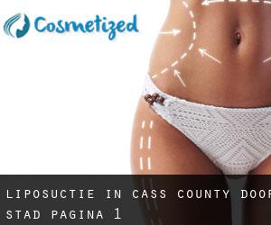 Liposuctie in Cass County door stad - pagina 1