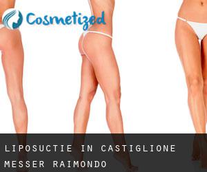 Liposuctie in Castiglione Messer Raimondo