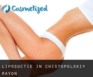 Liposuctie in Chistopol'skiy Rayon