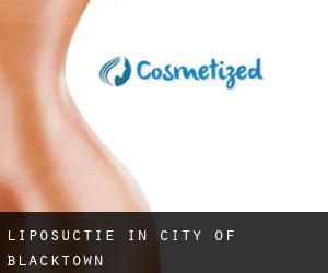 Liposuctie in City of Blacktown