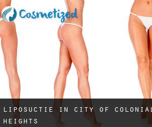 Liposuctie in City of Colonial Heights