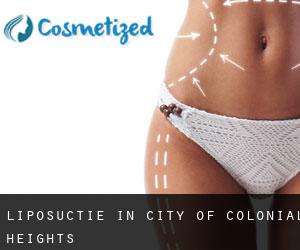 Liposuctie in City of Colonial Heights
