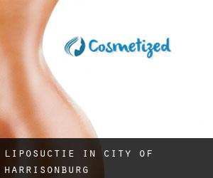 Liposuctie in City of Harrisonburg